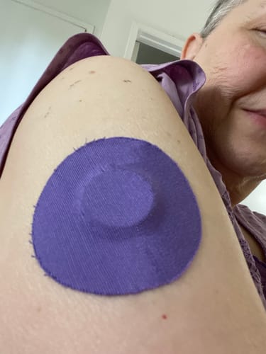 Customer photo review of Skin Grip Original - Freestyle Libre 2 Adhesive Patches - 20 Pack