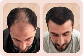 Customer photo review of Root Activator Styling Wax (CC)