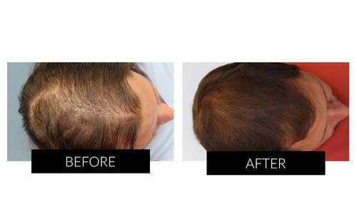 Customer photo review of Root Activator Styling Wax (CC)