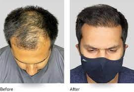 Customer photo review of Root Activator Styling Wax (CC)