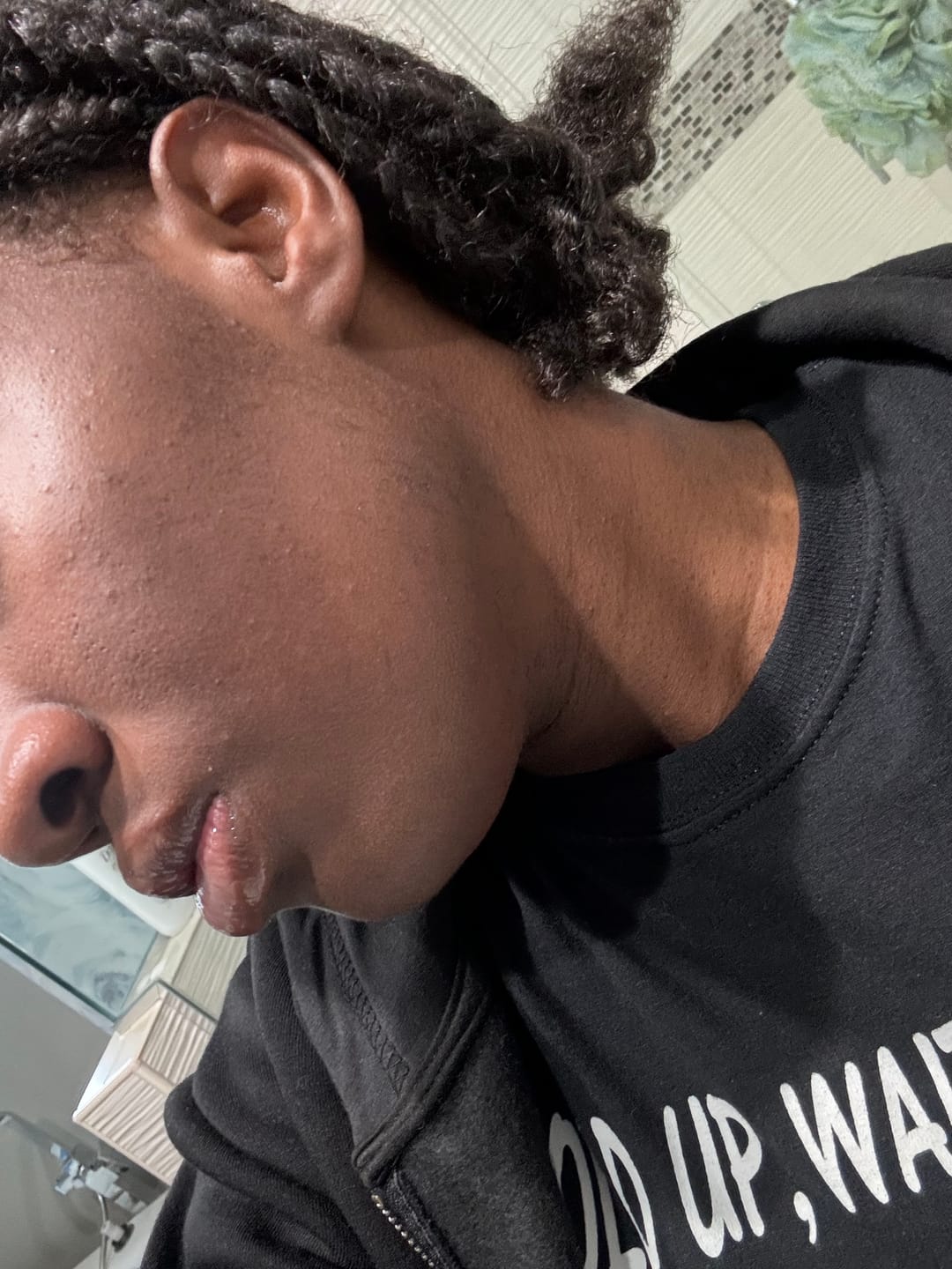Customer photo review of Glowbar 3% Salicylic Acid + 10% Sulphur Face and Body Soap Bar
