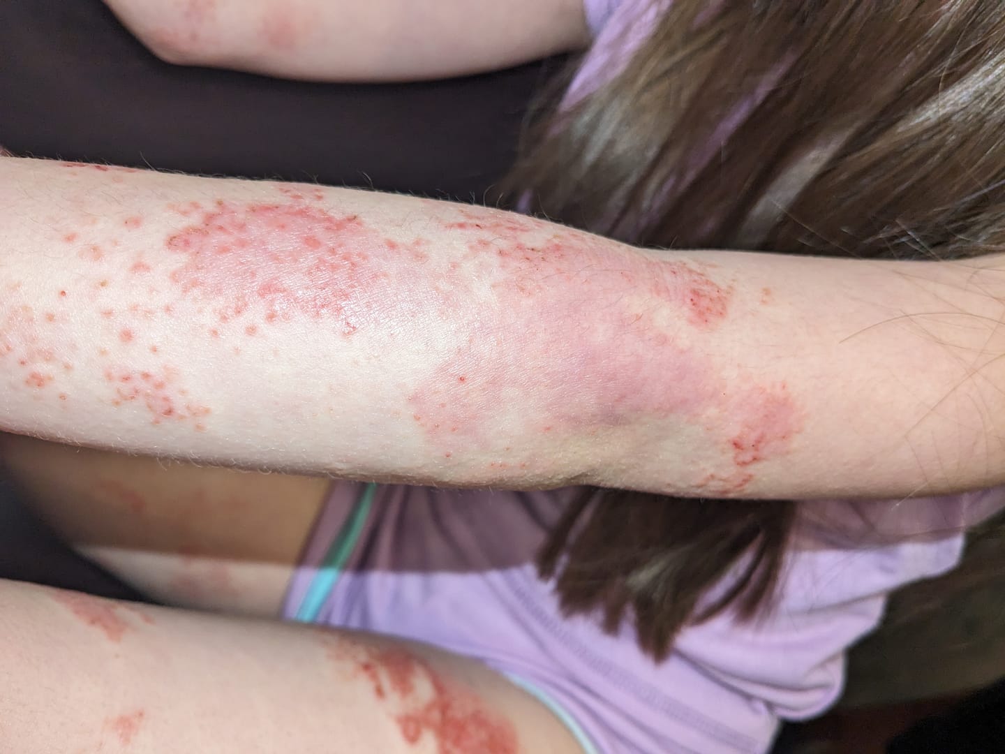 Customer photo review of Children’s Gut Rebalance Kit