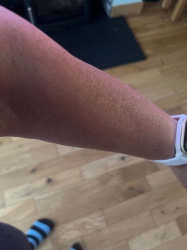 Customer photo review of Self Tanning | 150 Capsules