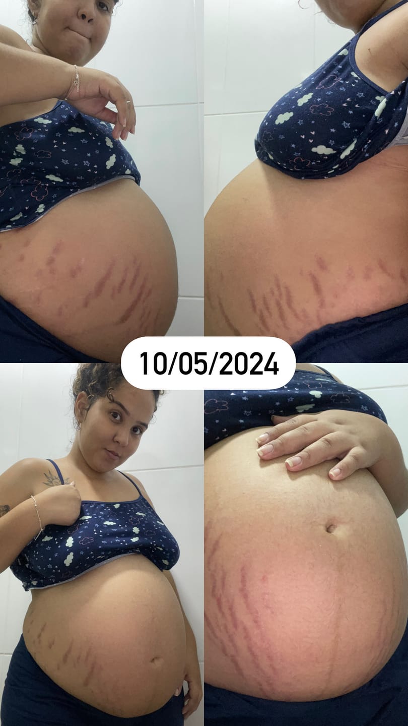 Customer photo review of Kit Duplinha