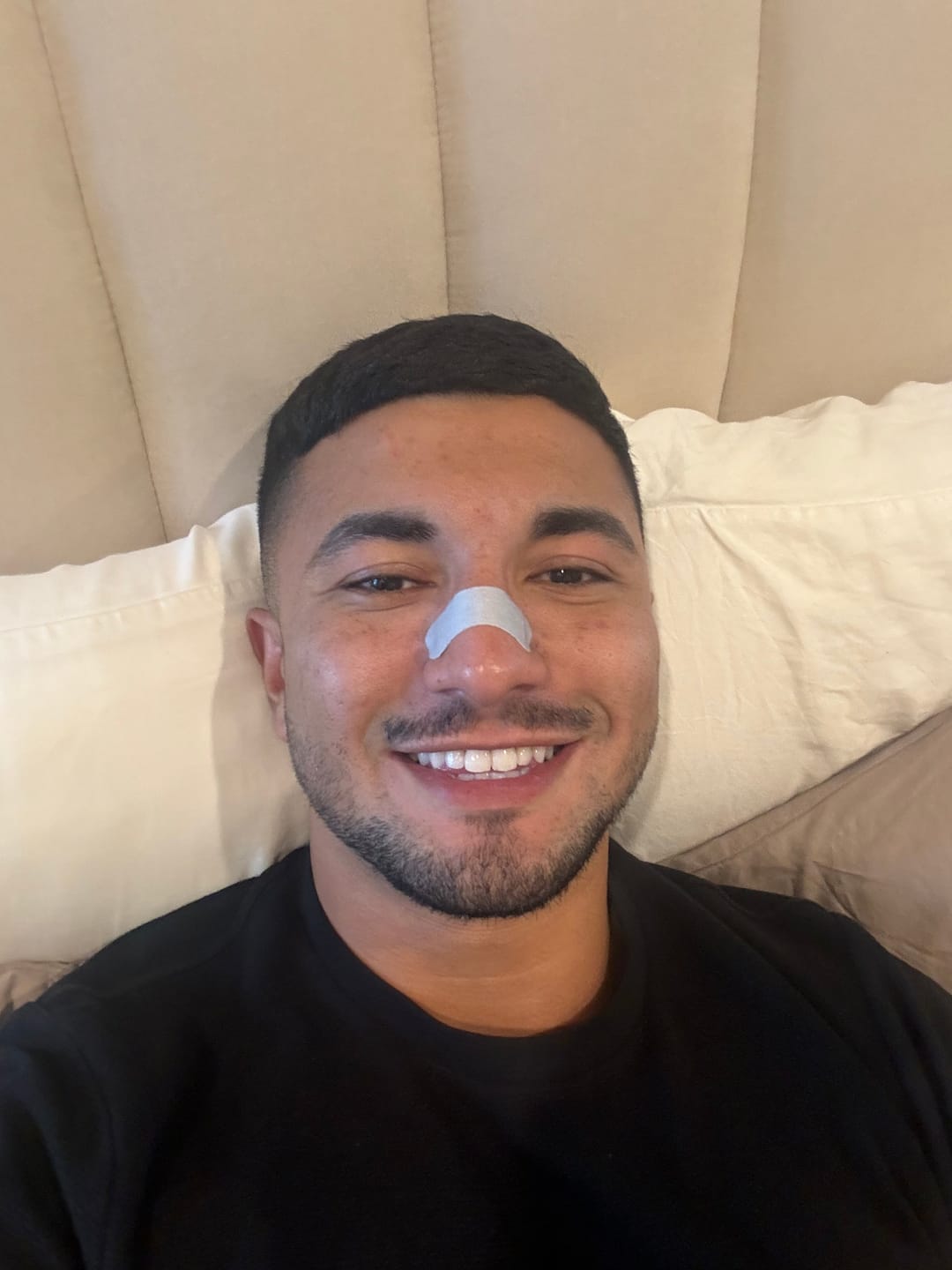 Customer photo review of Respire Nose Strips