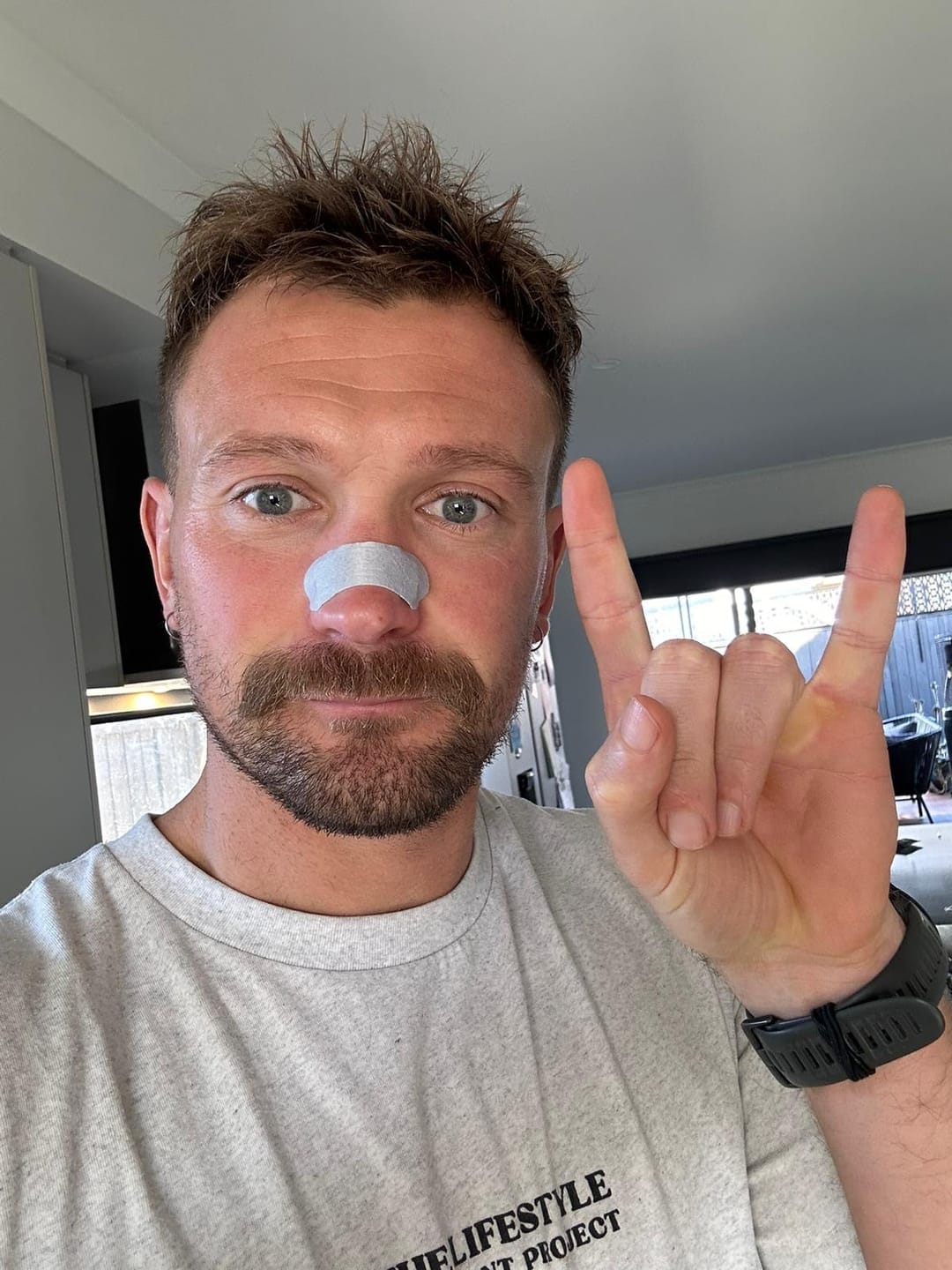 Customer photo review of Respire Nose Strips