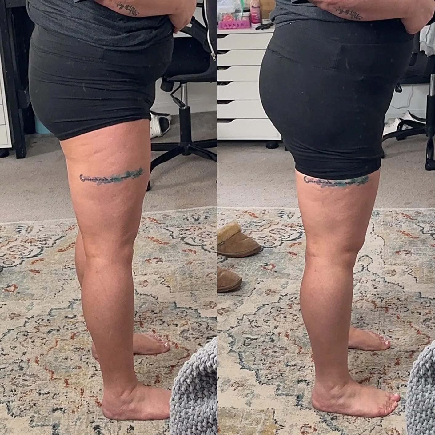 Customer photo review of Celeb-Booty Breast & Butt Enlargement Growth Oil 4oz