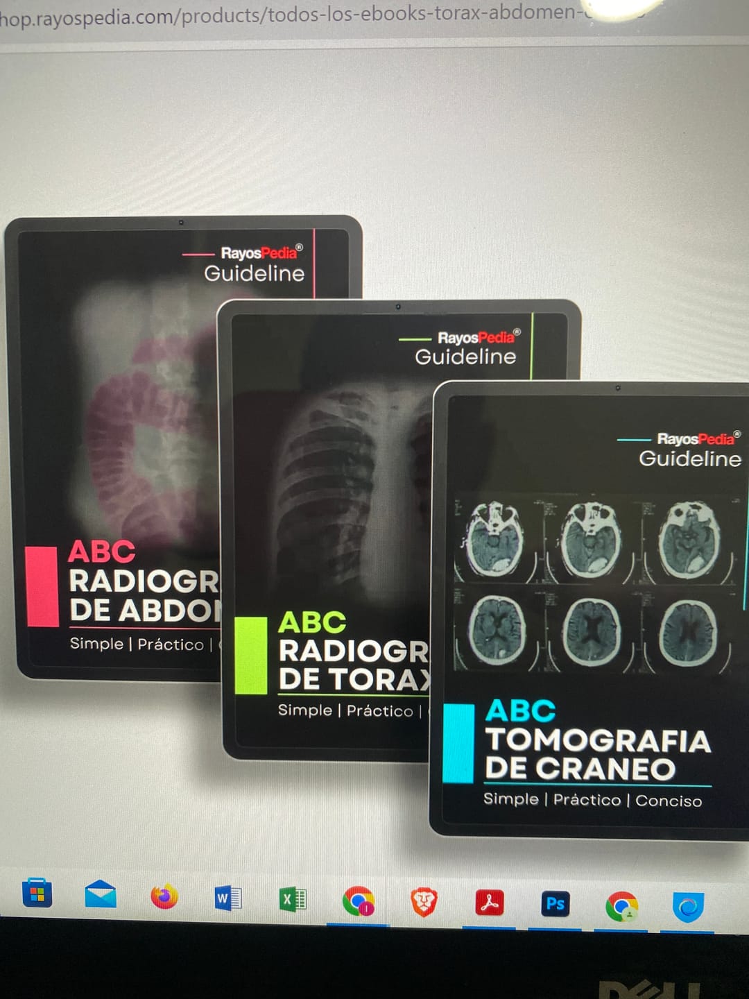 Customer photo review of Todos los Ebooks (Tórax+Abdomen+Cráneo)