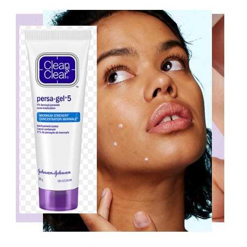 Customer photo review of Persa-Gel 10 28g