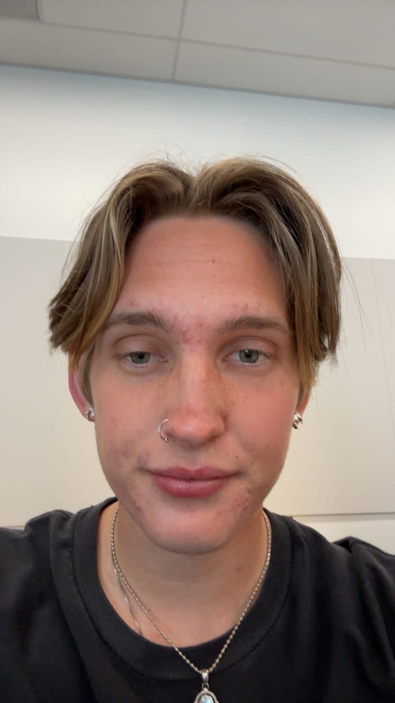 Customer photo review of LUNA THE LUNATIC LUNAR EARRING