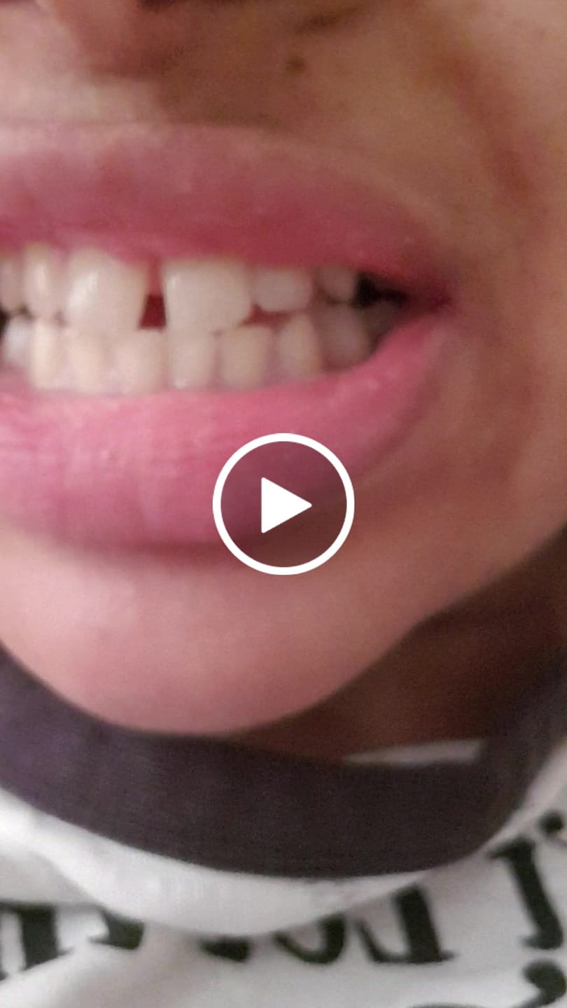 Customer video review of Coconut Oil Pulling Sachets