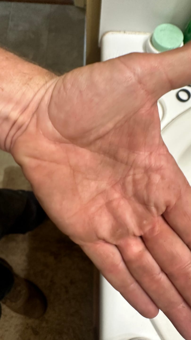 Customer photo review of The BEST Hand Cleaner