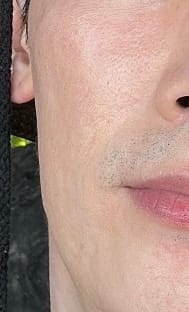 Customer photo review of Preparation B₅