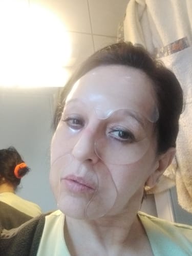 Customer photo review of Patchs Visage Anti-Rides Réutilisables FontanaySkin™