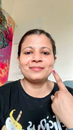 Customer photo review of Pigmentation & Dark Spot Corrector Gel Cream