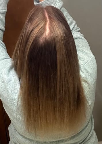 Customer photo review of Hair Growth Kit (2 month supply)