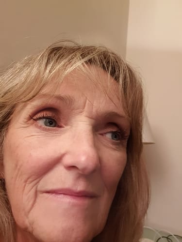 Customer photo review of iGlow Lash Maximizer - Lash Serum, 3 ml