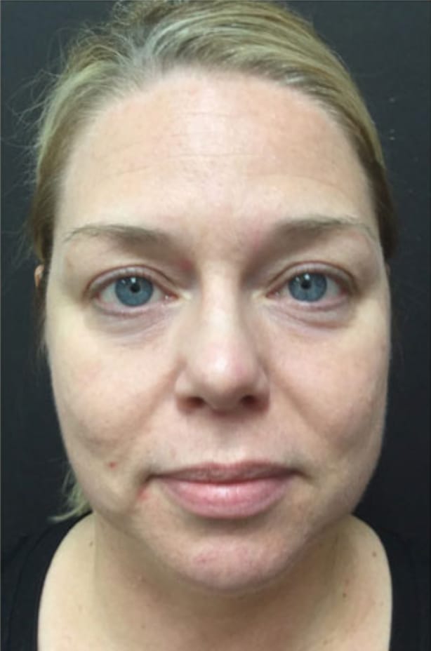 Customer photo review of Under Eye Skincare Wand