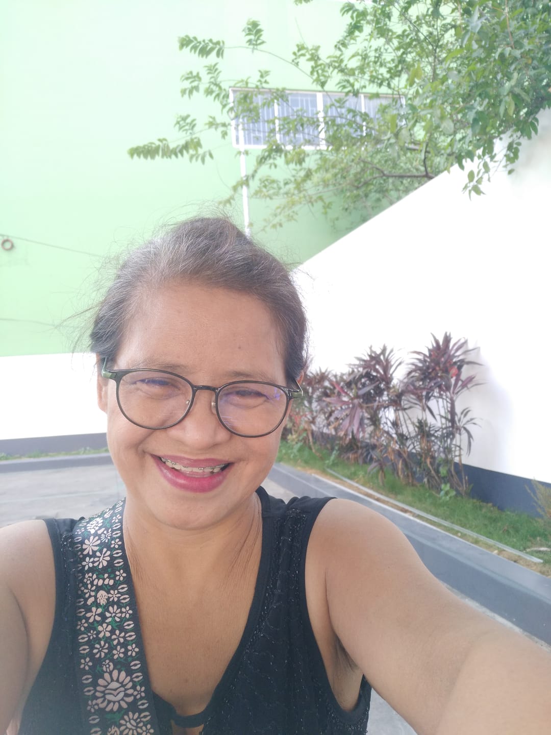 Customer photo review of Rosmar gluta peeling soap