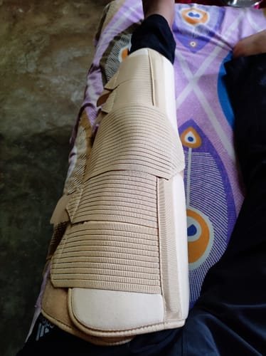 Customer photo review of Knee Stabler - Long (19" Brace) |Ideal firm Knee support that limits knee motion & stabilizes the knee with mediolateral metal supports | Color - Black