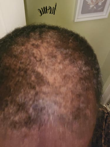 Customer result