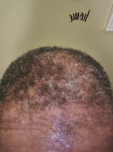 Customer result