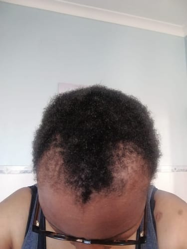 Customer photo review of MIZANI 25 MIRACLE LENGTH SERUM 90ML