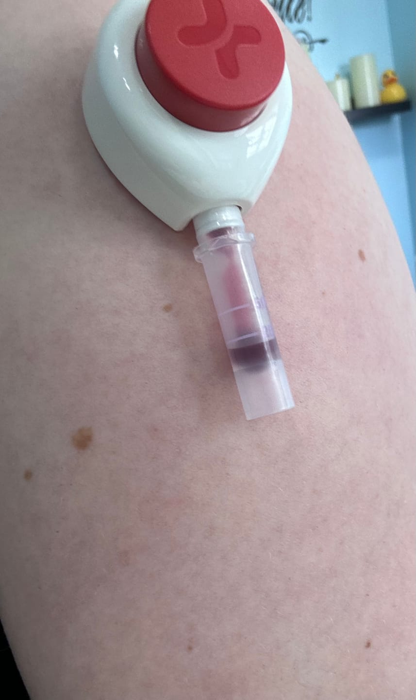 Customer photo review of EarlyReveal Tap DNA Gender Test Over 99% Accurate | Painless & Needle Free | Next Day Results