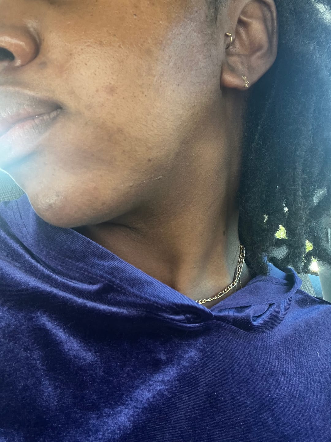 Customer photo review of BERRI-CLEAR+ 5 BERRY SUPERFRUIT SERUM
