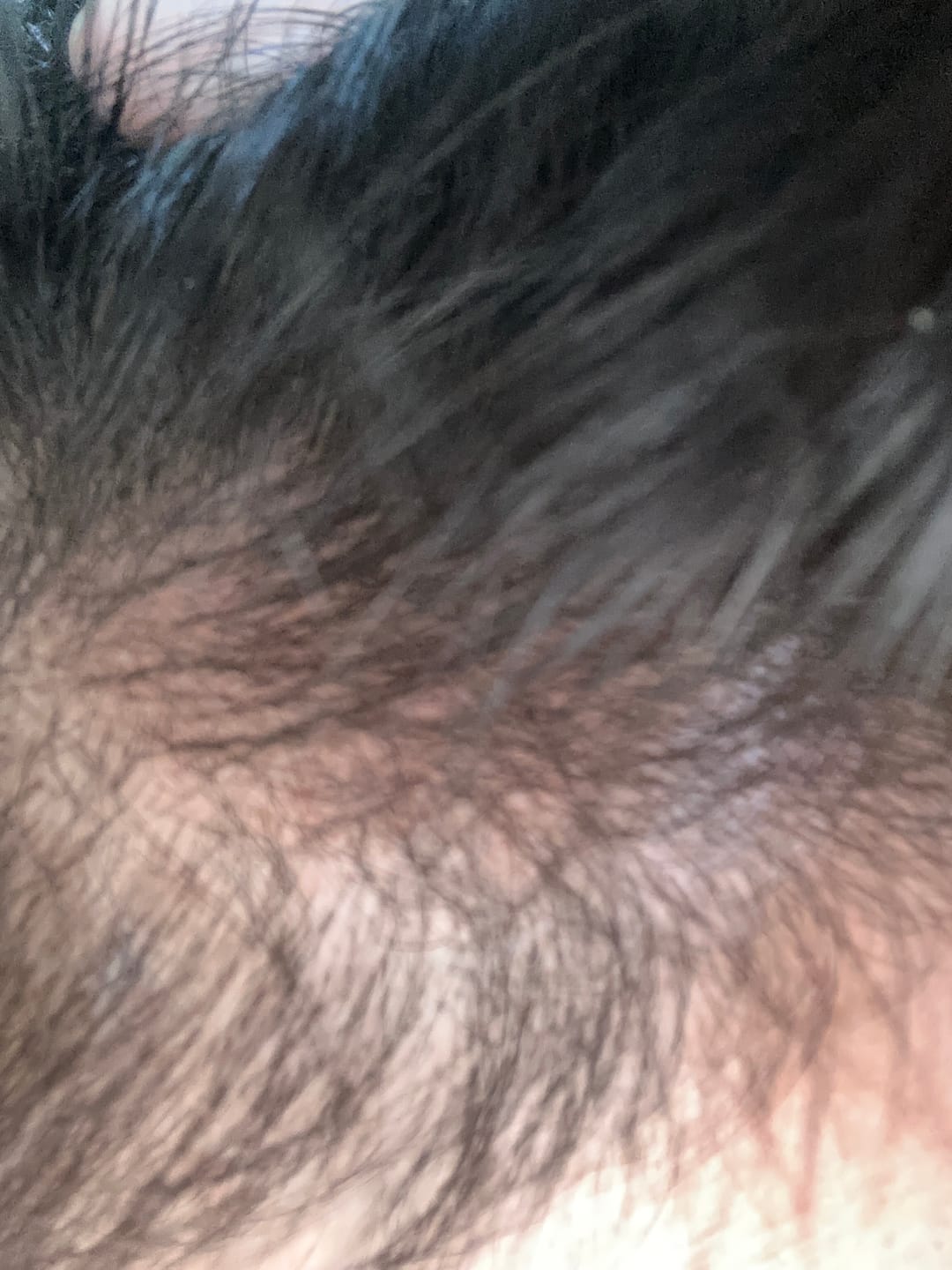 Customer photo review of Enrich Hair Growth Oil