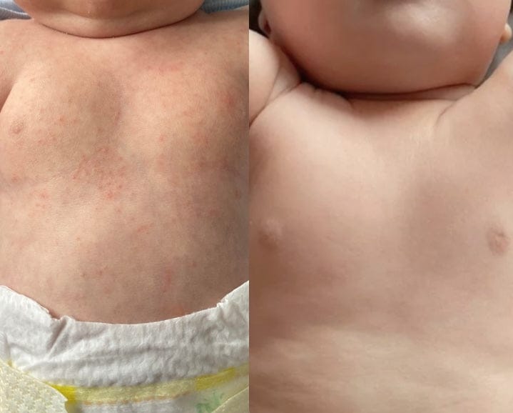 Customer photo review of Skincare Bath Filter by Kinder Filter