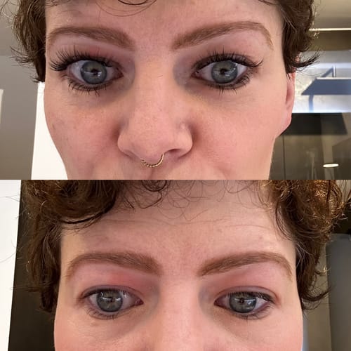 Customer photo review of Starter Bundle