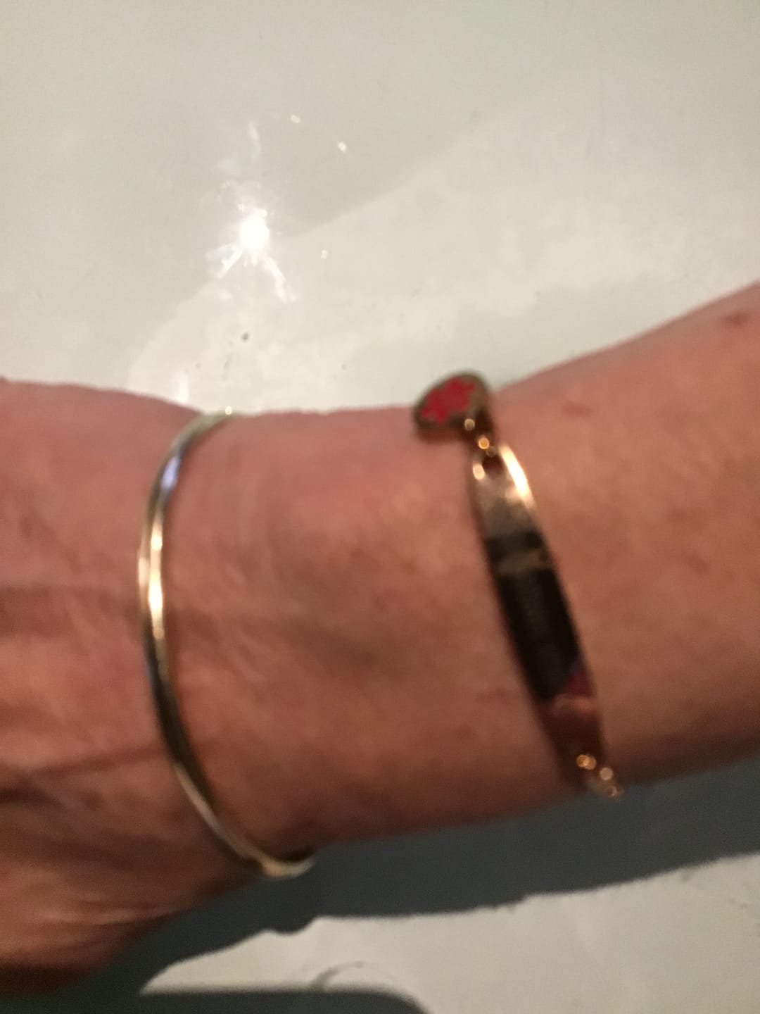 Customer photo review of Personalised Medical Alert Heart Link Bracelet - Rose Gold