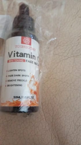 Customer photo review of Sérum Niacinamide + Vitamine C Anti taches et acné