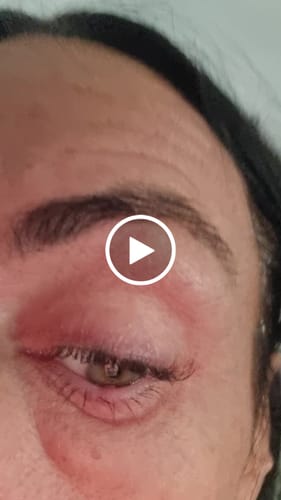 Customer video review of iGlow Brow Maximizer - Brow Serum, 4 ml