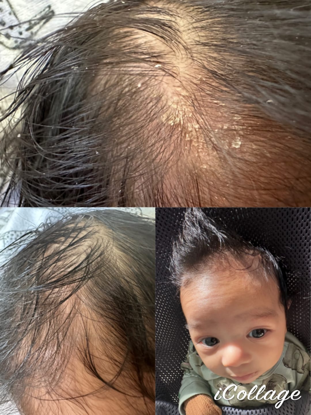Customer photo review of DermaGen Manuka Balm - Your #1 Mulitpurpose Balm for the Family