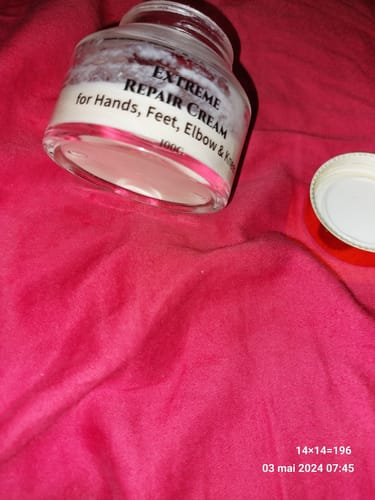 Customer photo review of Extreme Dark Hands Feet Knees And Elbows Repair Cream