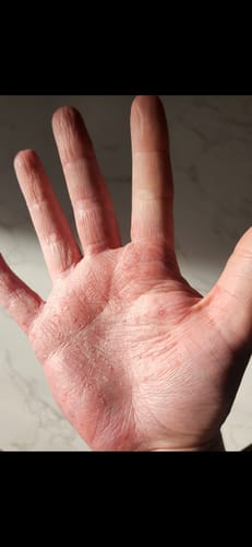 Customer photo review of Biolipid Complex - Firming Body Oil