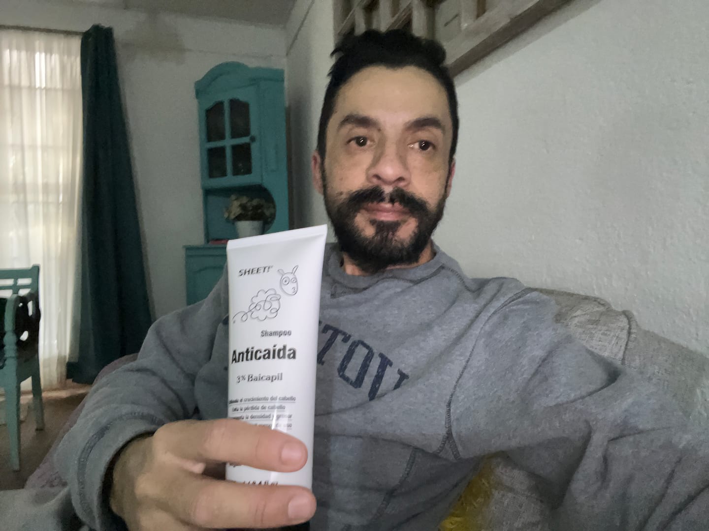 Customer photo review of Shampoo Anticaída