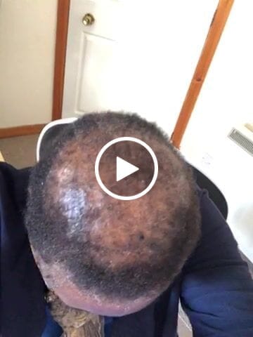 Customer video review of Drizzle & Drizzle Refill Bundle