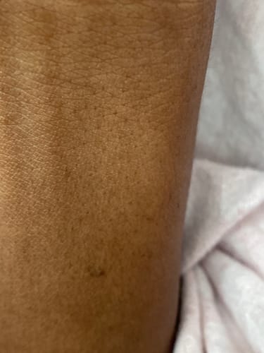 Customer photo review of Organic Extract of Tamarind Serum 30ml