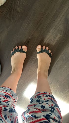 Customer photo review of Separadores de dedos