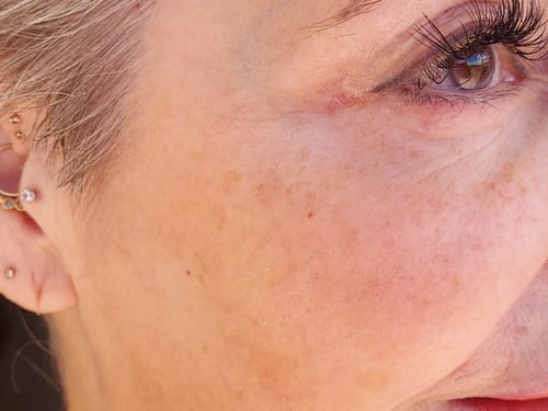 Customer photo review of HA Serum