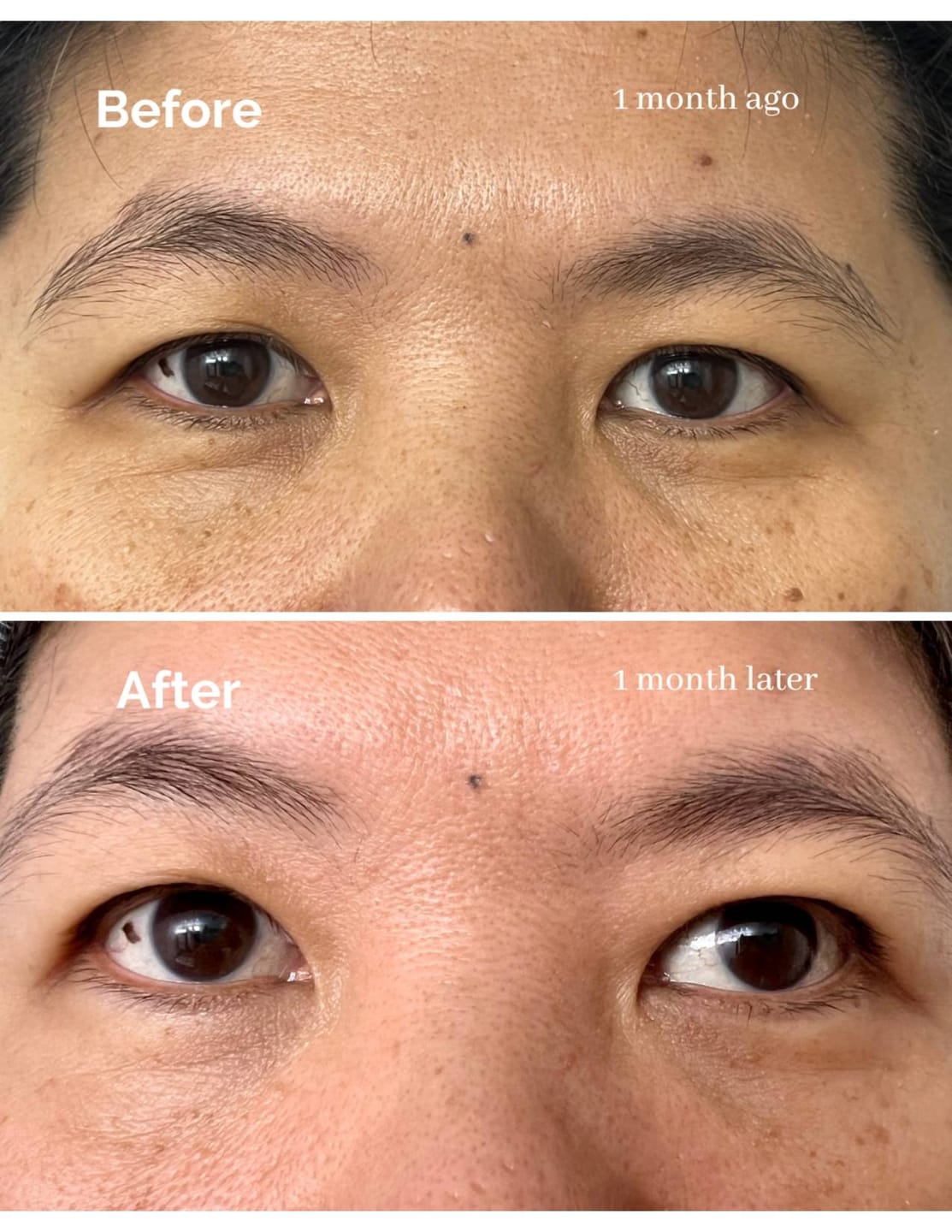 Customer photo review of Under Eye Anti-Aging Wand
