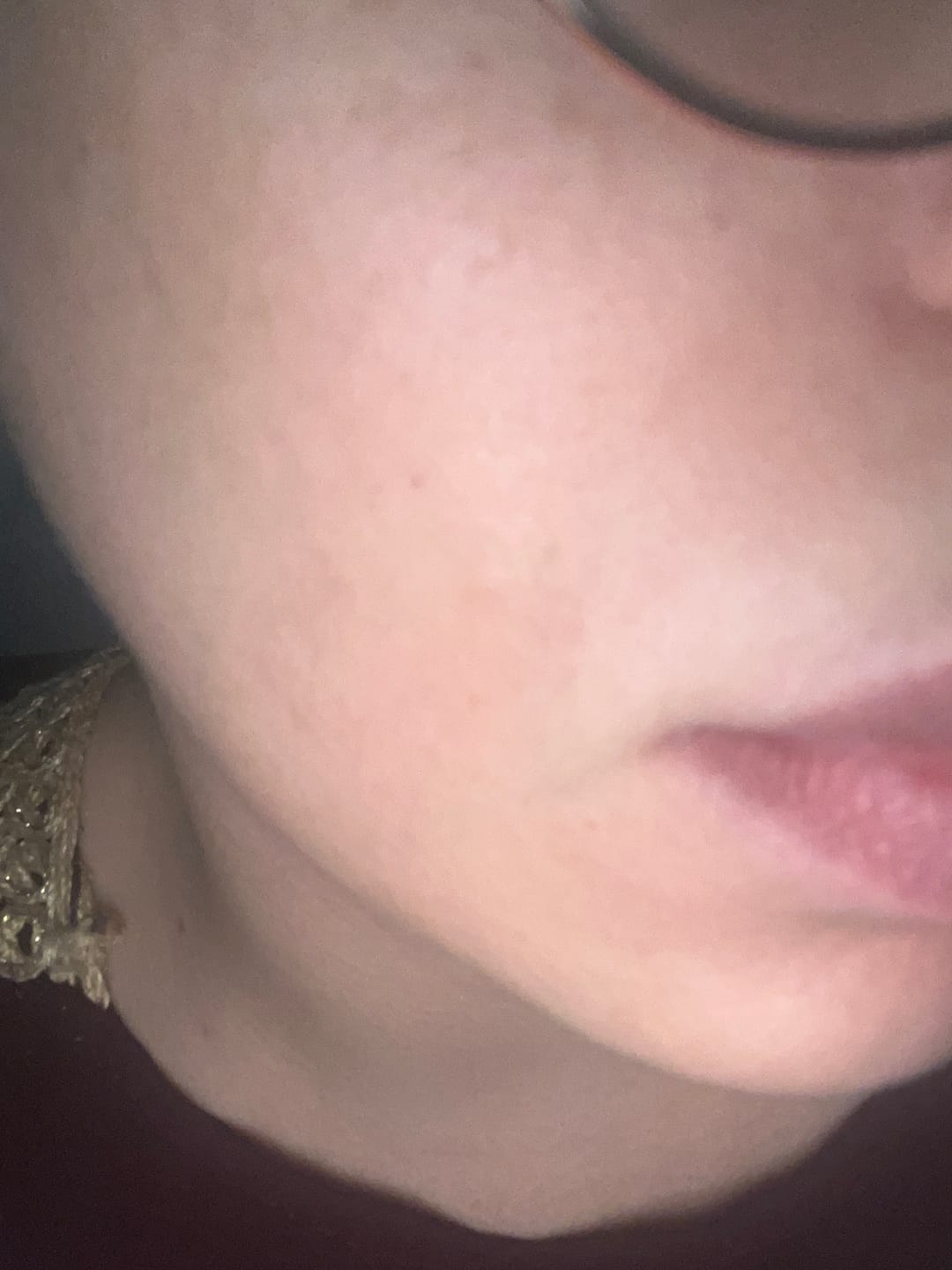 Customer photo review of Anua - Huile nettoyante - Heartleaf Pore Control Cleansing Oil