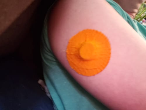 Customer photo review of Skin Grip Original - Dexcom G7 Adhesive Patches - 20 Pack