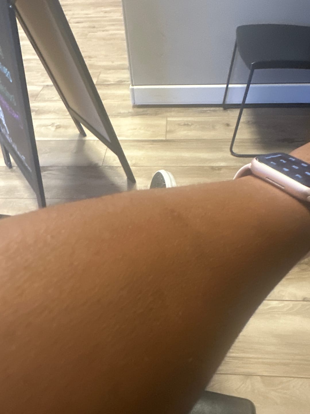 Customer photo review of Fair and White So White Skin Perfector Body Lotion 500ml / 16.90 fl oz
