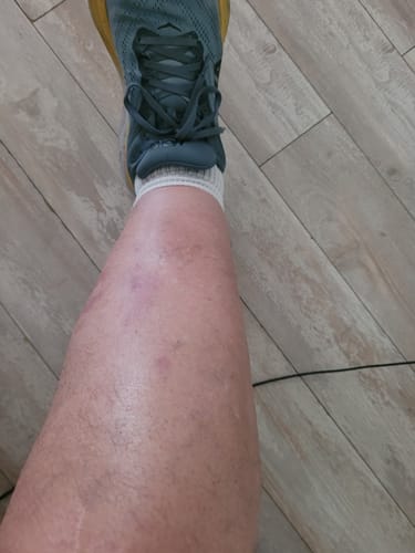 Customer photo review of CBD Infused Massage Lotion