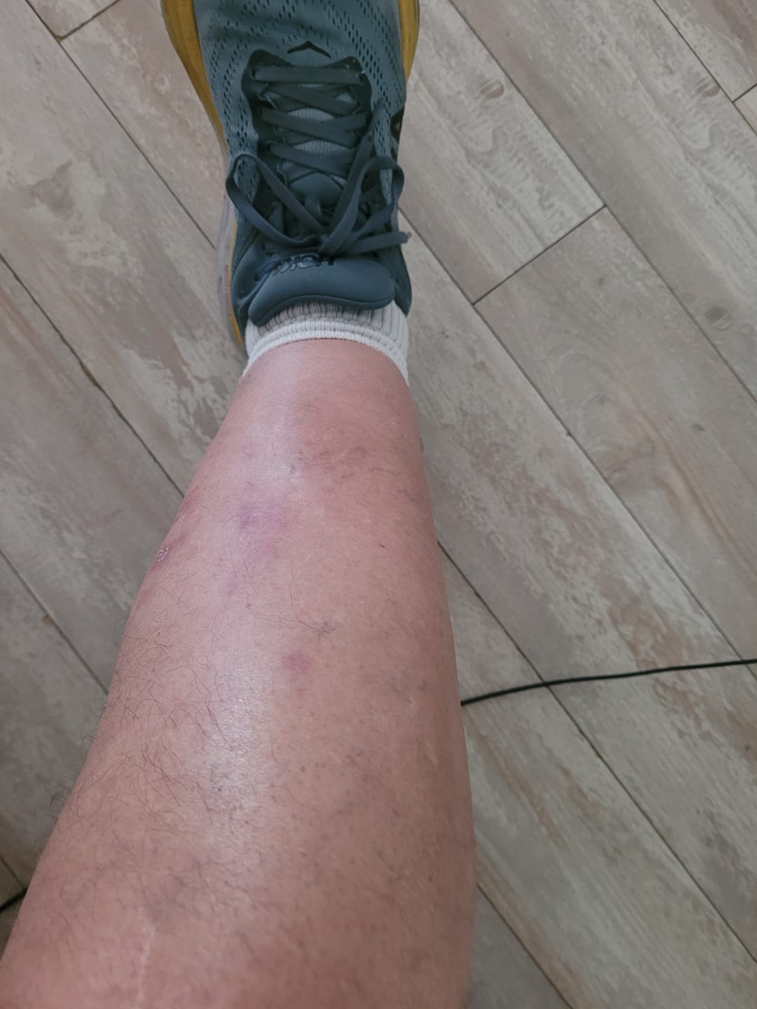 Customer photo review of CBD Infused Massage Lotion