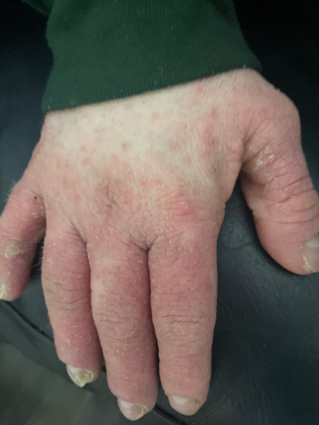 Customer photo review of Prebiotic Hand Cream